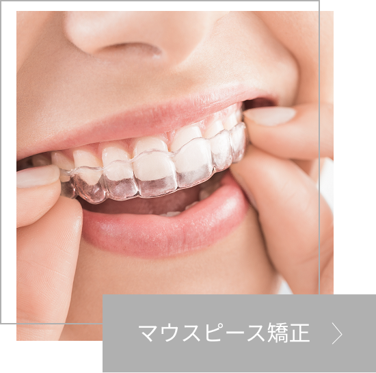 マウスピース矯正の画像