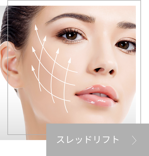 スレッドリフトの画像