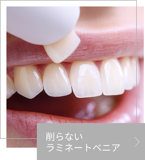 ラミネートベニヤの画像